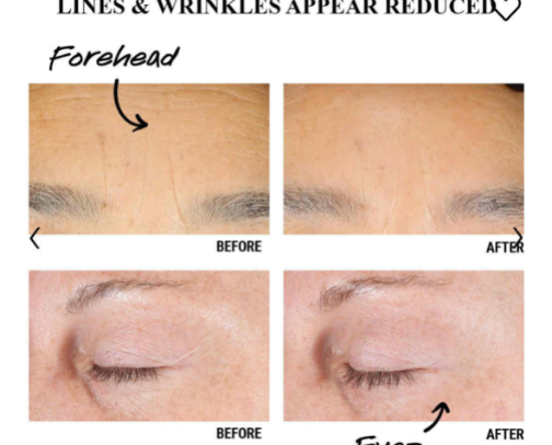 Let’s have a perfect skin 🫶 cover photo collage