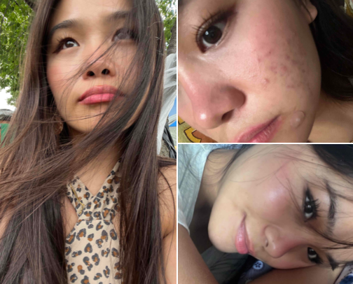skin care that actually works(for my skin but give it a try) cover photo collage