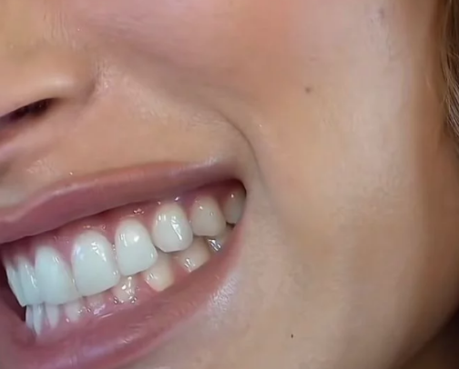 Everything I Do for Fresh Breath & a Whiter Smile. cover photo collage