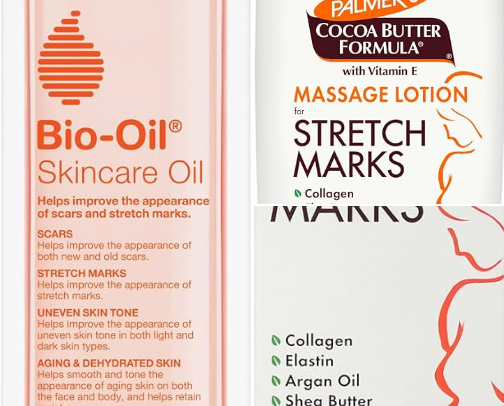 🌸 Affordable Stretch Mark Treatments That Actually Feel Worth It cover photo collage