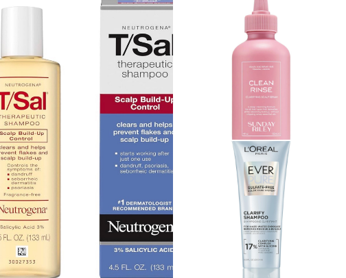 Itchy scalp routine that...works? cover photo collage