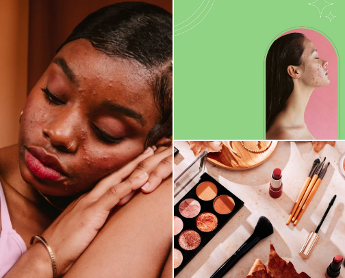 Acne Safe Makeup 🩵 cover photo collage