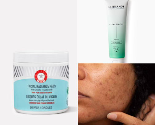 TOP Skincare for discoloration cover photo collage