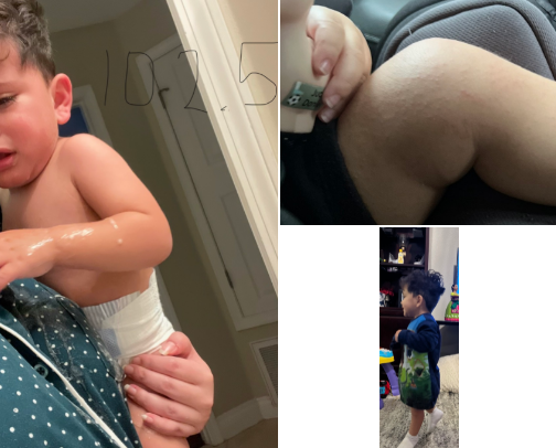 Helpful: HFMD(Hand Foot and Mouth Disease) items for 18 month old cover photo collage