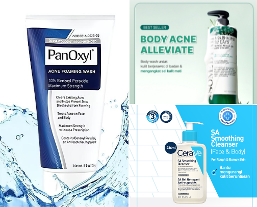 ✨ Struggling with back acne, tiny bumps, or rough skin texture? cover photo collage