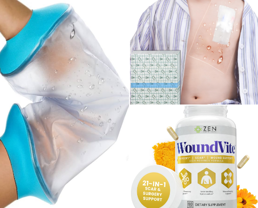 Products I Use To Help Prevent & Treat Scars cover photo collage