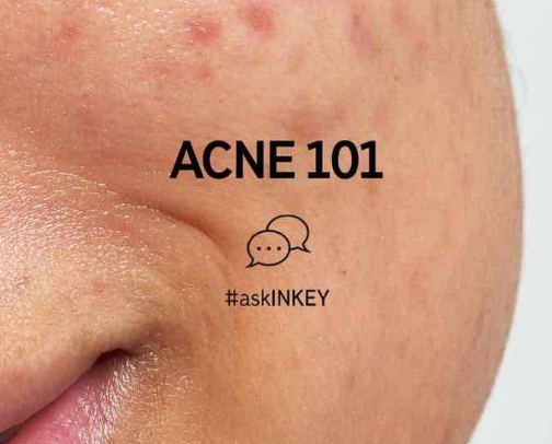 Clear Skin Must-Haves cover photo collage