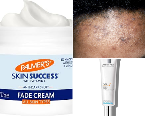 Hyperpigmentation Shelf ✨ cover photo collage