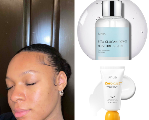 ACNE SAFE SKINCARE/ MAKEUP (From a Licensed Esthetician) 🫧 cover photo collage