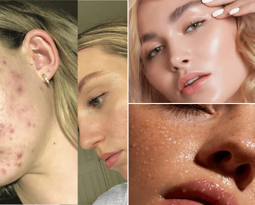 Skin care/cosmetics cover photo collage