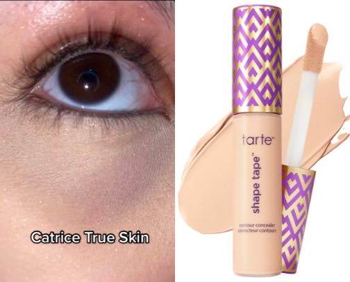 I I Have Really Dark Circles — Honest Concealer Reviews With Real Before & Afters cover photo collage
