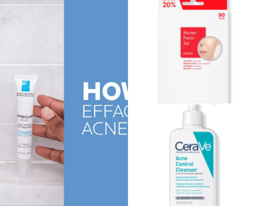 SKINCARE ACNE MUST YOU TRY cover photo collage