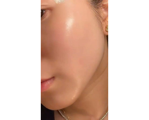 Healthy skin looks like this 👀✨ cover photo collage