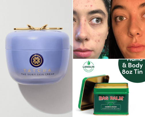 Sensitive Acne Prone Skin Care cover photo collage