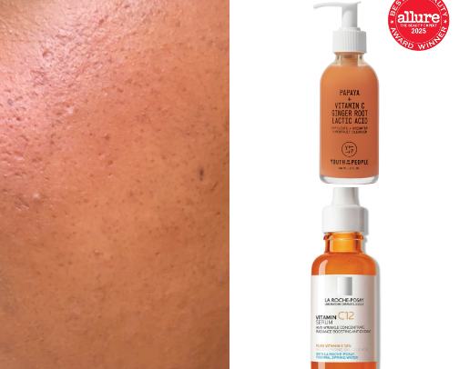 Hyperpigmentation ?: Skin Care Must Haves 🧴💆🏼‍♀️💆🏽‍♀️💆🏾‍♀️💆🏿‍♀️🫧 cover photo collage