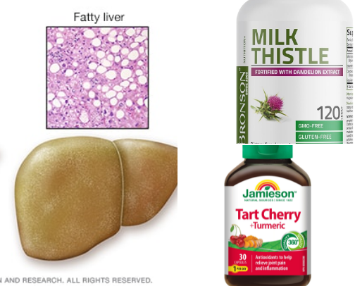 Simple Liver Health Habits and Items That Actually Help cover photo collage