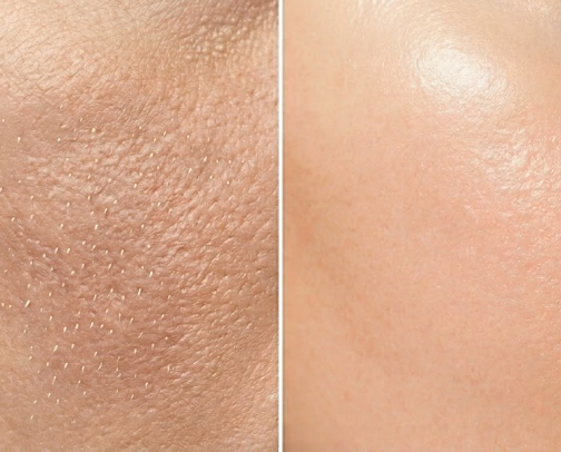 Products That Fixed My Skin Texture cover photo collage
