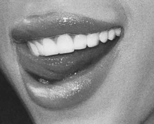 MY SHINY TEETH & ME cover photo collage