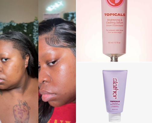 Dark-Spot Products Worth Repurchasing cover photo collage