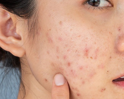 Top-Rated Dark Spot & Hyperpigmentation Serums That Actually Work cover photo collage