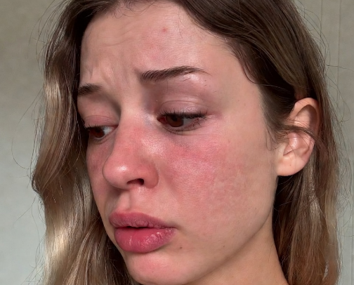 Korean Skincare MISTAKES You Might Be Making cover photo collage