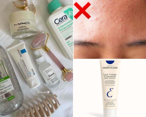 Must have skincare for dry skin cover photo collage