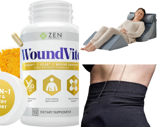 Weight Loss/Surgery Post op tips and tricks cover photo collage