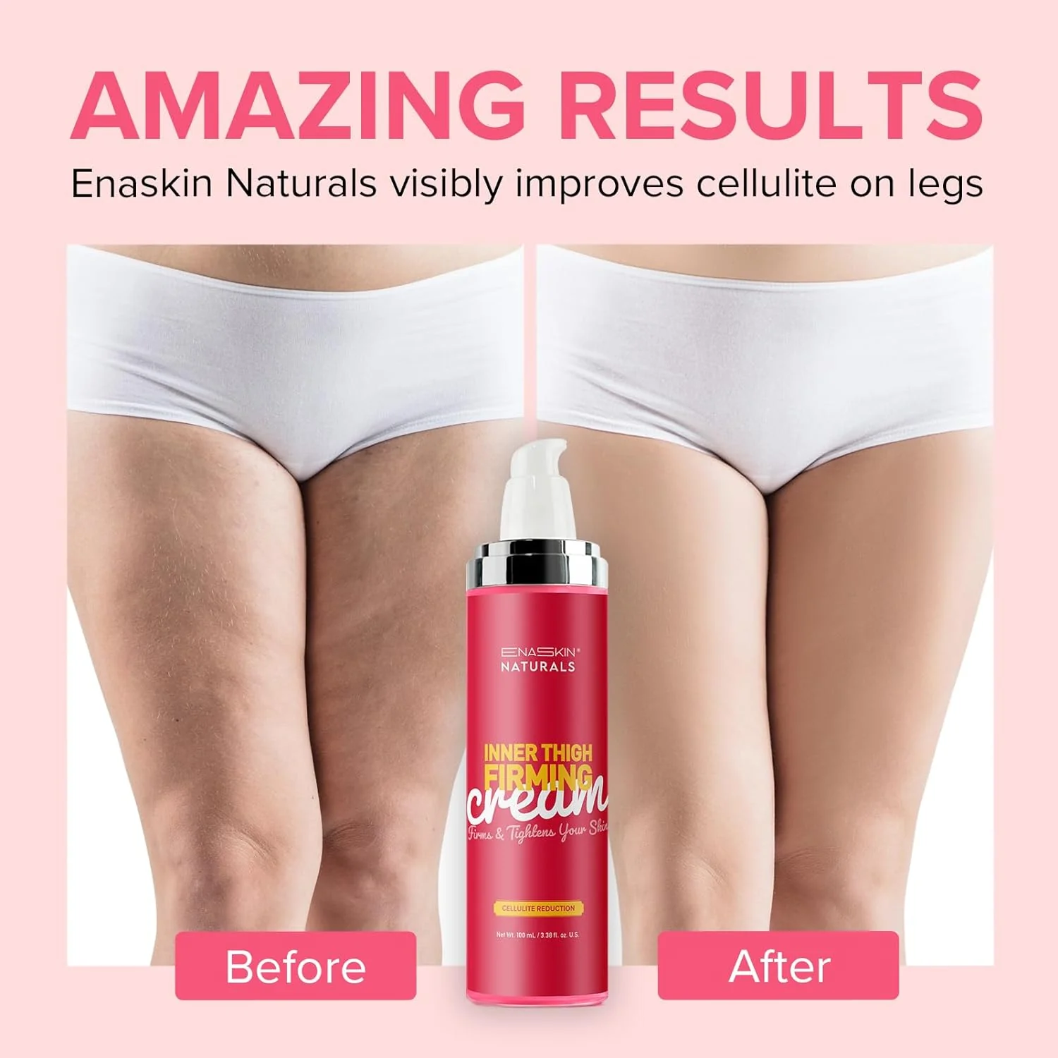 Kiss your Cellulite Goodbye! cover photo collage