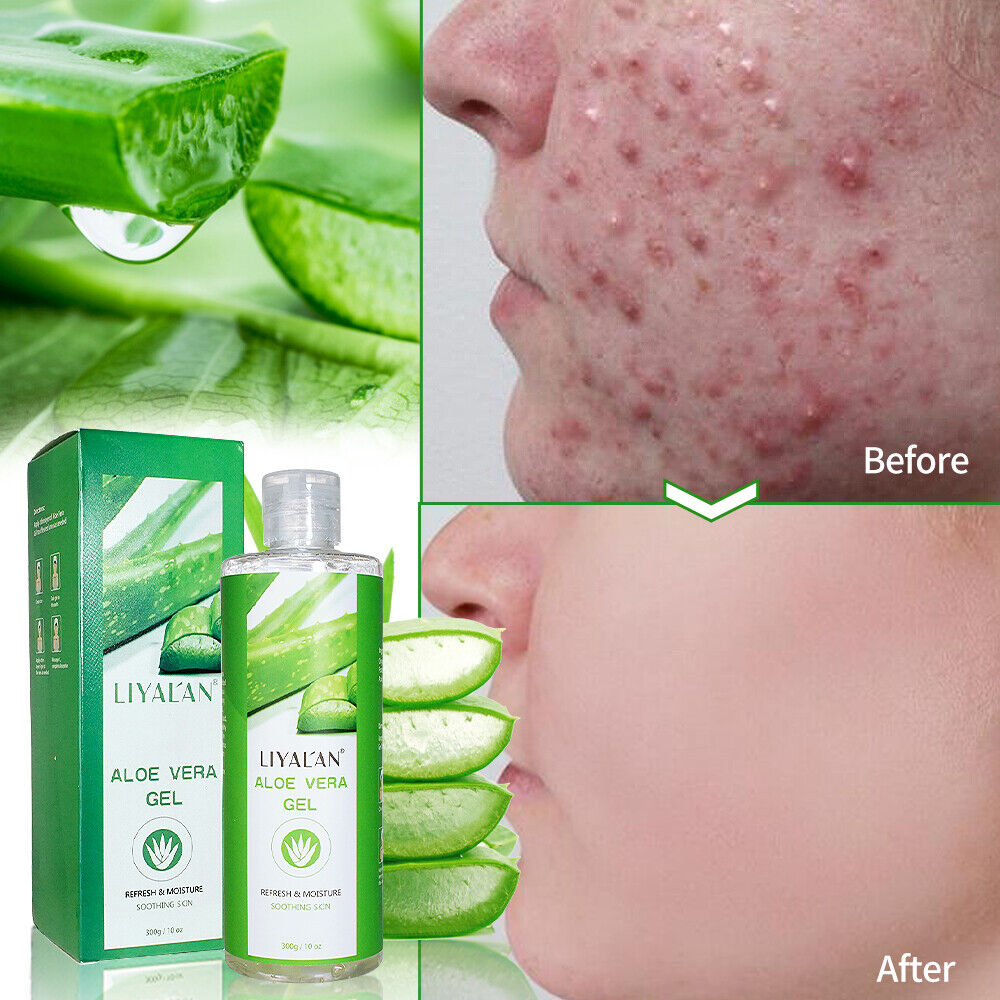 Skin care