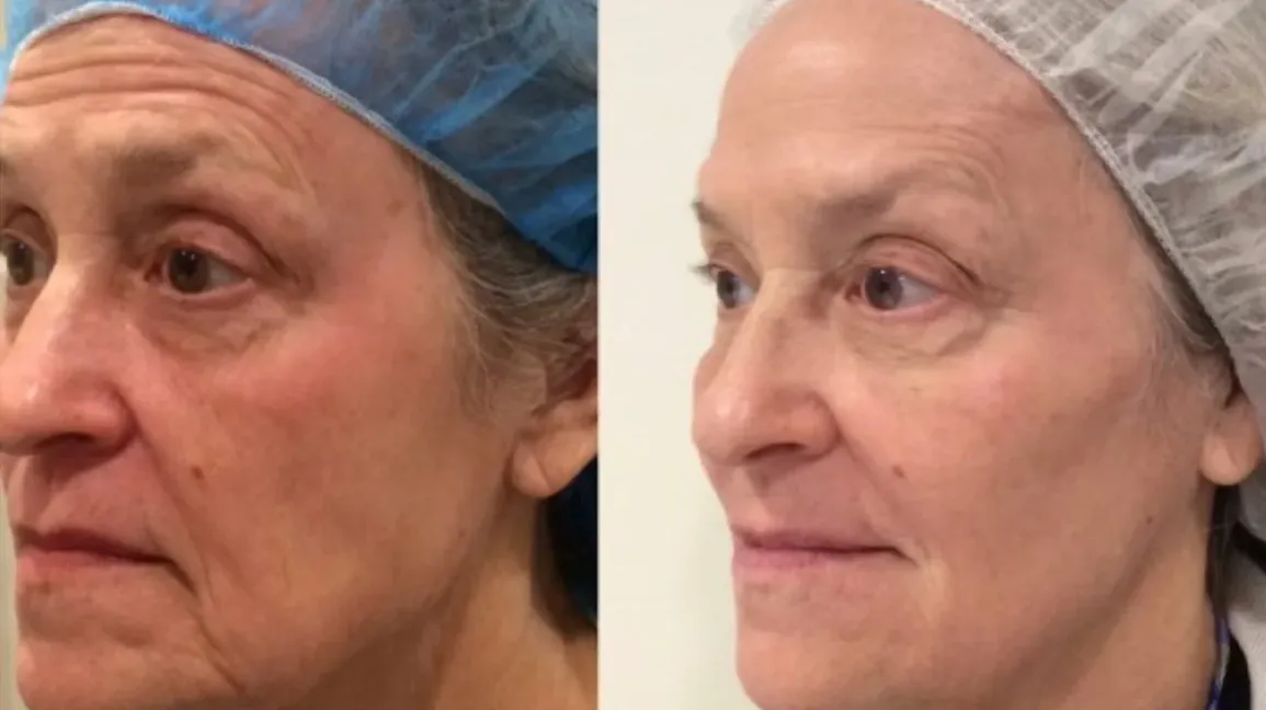 Things to improve your skin! cover photo collage