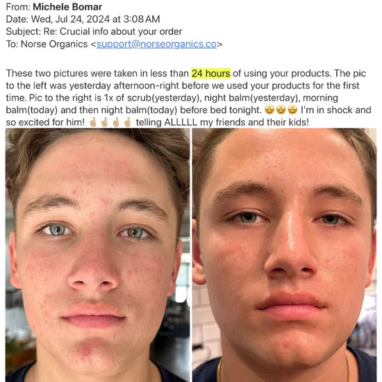acne prone skin cover photo collage