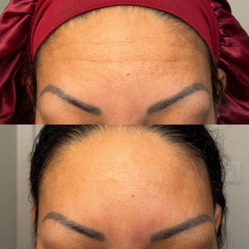 glow and tell as an acne prone girlie focused on anti-aging cover photo collage
