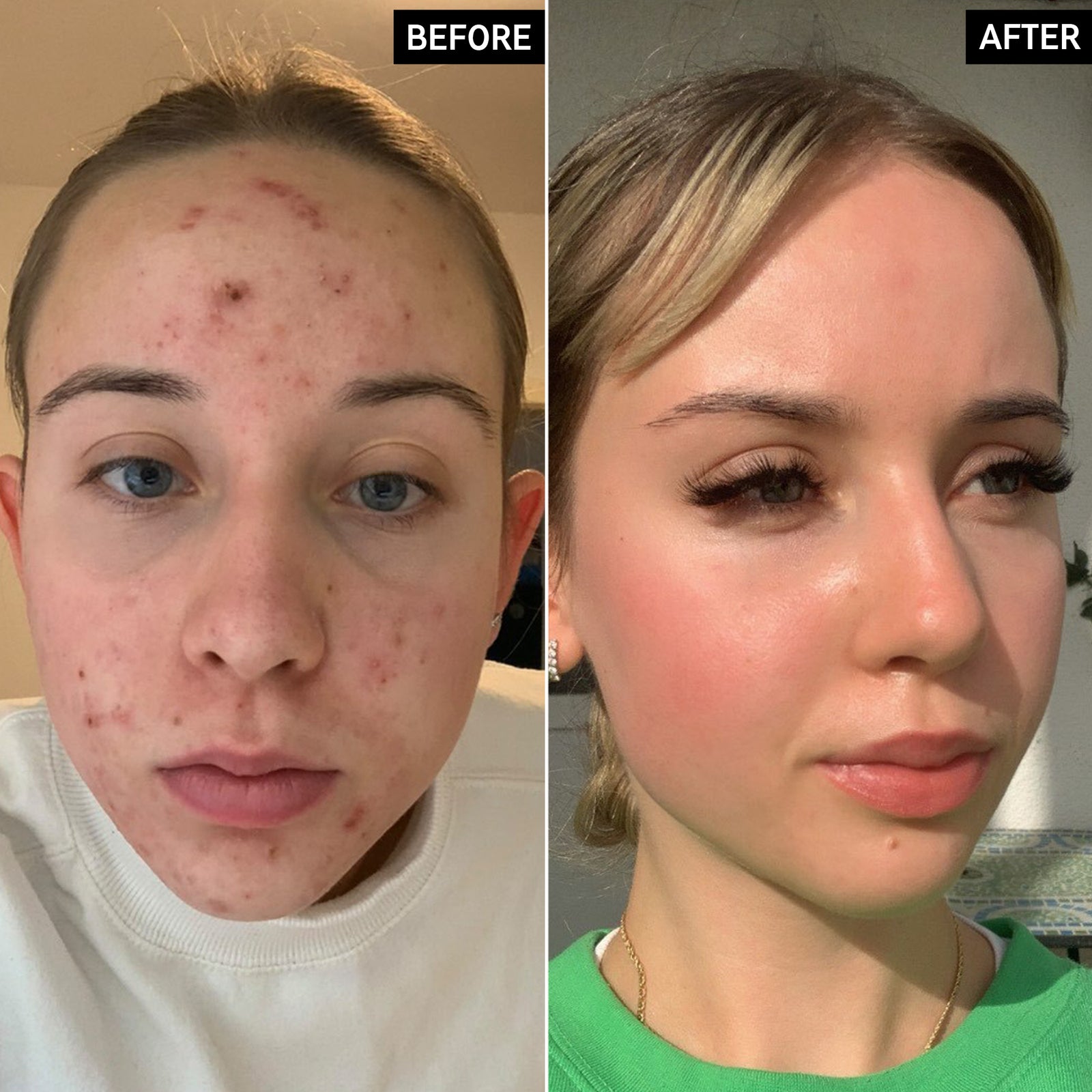 Skincare Routine cover photo collage